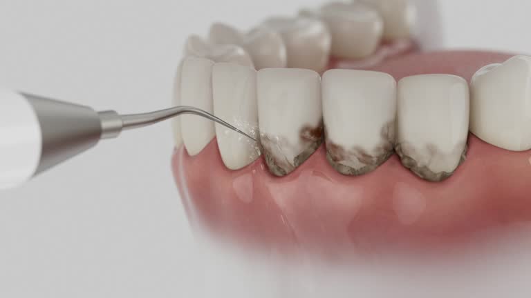 Reliable Dental contractor in French Camp, CA by Dentist Open Now